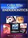 Color Atlas of Endodontics