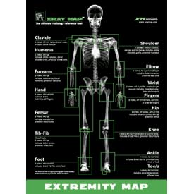 Xray Map - The Extremity Map Poster Size 24" x 36"