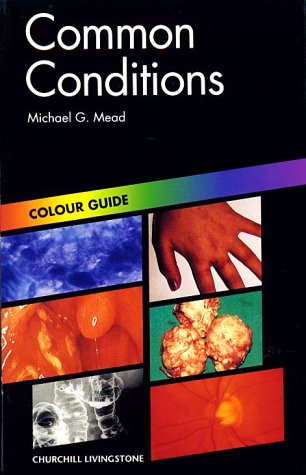 Conditions and Diseases