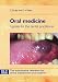 Complete Dentures: Problem Solving