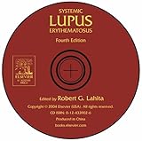 Systemic lupus erythematosus