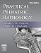 Practical Pediatric Radiology chez Livres sur le nom: 513RP8DZG6L._SL75_