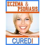 Eczema & Psoriasis: CURED! (Eczyma & Psoriasis)