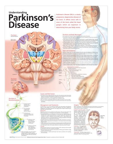 Understanding Parkinson's Disease Anatomical Chart