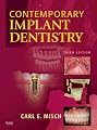 Contemporary Implant Dentistry