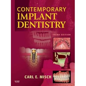 Contemporary Implant Dentistry by Carl E. Misch DDS MDS PHD(HC)