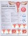 Understanding Cervical Cancer Anatomical Chart