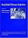 Brachial Plexus Injuries