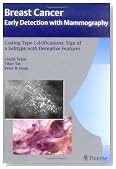 Casting Type Calcifications: Sign of a Subtype with Deceptive Features (Breast Cancer - Early Detection with Mammography)