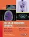 Nuclear Medicine Imaging: A Teaching File (LWW Teaching File Series)