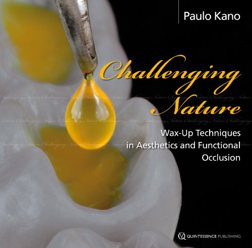Challenging Nature