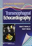 A practical approach to transesophageal echocardiography