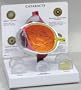 Cataract Eye, Anatomical Model, Set of 5 Interchangeable Lens
