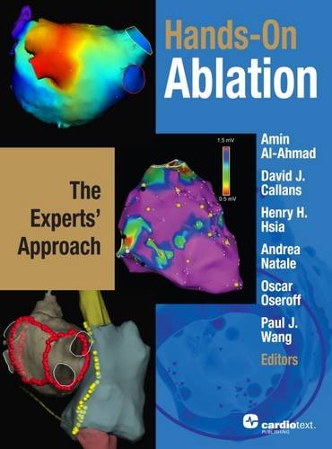 Hands-on Ablation: The Experts' Approach Hands-on Ablation: The Experts' Approach