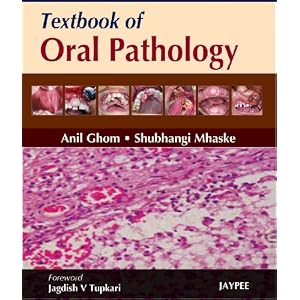 Click here to buy Textbook of Oral Pathology by Ghom.