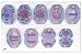 3B Scientific Mitosis Series