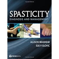 Spasticity: Diagnosis and Management