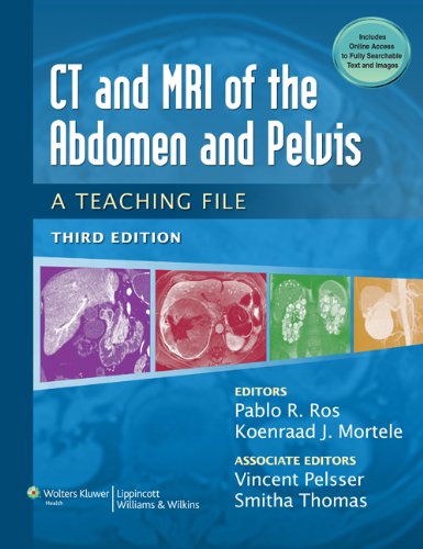 CT & MRI of the Abdomen and Pelvis: A Teaching File: A Teaching File (LWW Teaching File Series)