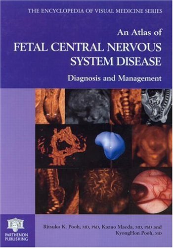 Atlas of Fetal Central Nervous System Disease (Encyclopedia of Visual Medicine)