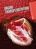 Organ transplantation