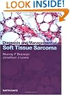 Diagnosis and Management of Sarcoma