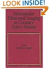 Intravascular Ultrasound Imaging in Coronary Artery Disease (Fundamental and Clinical Cardiology)