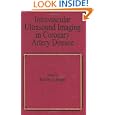 Intravascular Ultrasound Imaging in Coronary Artery Disease (Fundamental and Clinical Cardiology,... by Siegel
