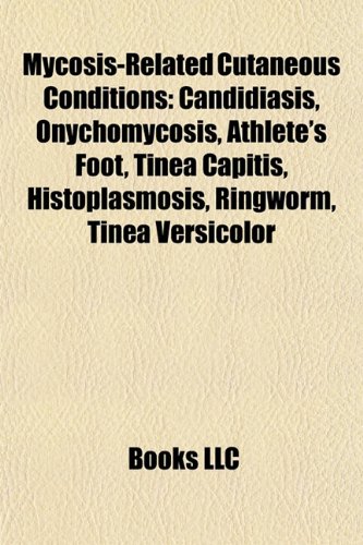 sporotrichosis