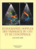 Echographie doppler des vaisseaux du cou et de l\'encéphale