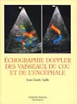 Echographie doppler des vaisseaux du...