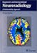 Book Diagnostic and Interventional Neuroradiology: A Multimodality Approach