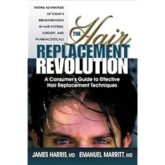 The Hair Replacement Revolution: A Consumer's Guide to Effective Hair Replacement Techniques