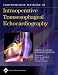 Comprehensive Textbook of Intraoperative Transesophageal Echocardiography
