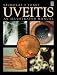 Uveitis: An Illustrated Manual