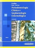 Periodontologia Clinica E Implantologia Odontologica, Vol. 1 (Spanish Edition)