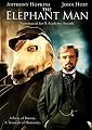 The Elephant Man