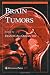 Brain Tumors (Contemporary Cancer Research)