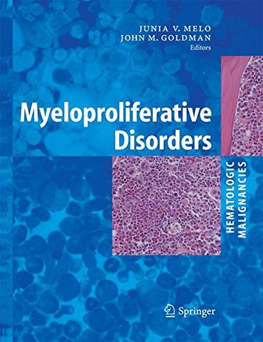 Myeloproliferative Disorders (Hematologic Malignancies)