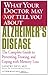 What Your Doctor May Not Tell You About(TM) Alzheimer's Disease: The Complete Guide to Preventing, Treating, and Coping with Memory Loss