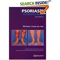 Psoriasis: A Patient's Guide