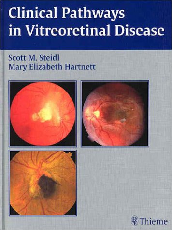 Image of: Clinical Pathways In Vitreoretinal Disease