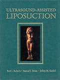 Ultrasound-Assisted Liposuction by Quality Medical Publishing