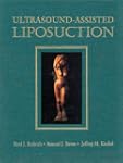 Ultrasound-Assisted Liposuction