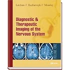 Click here to buy Imaging of the Nervous System: Diagnostic and Therapeutic Applications by Richard Latchaw, John Kucharczyk, and Michael Moseley.