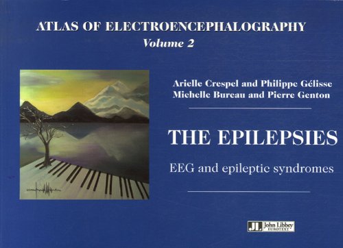 Epilepsy