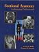Sectional Anatomy for Imaging Professionals