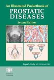 An Illustrated Pocketbook of Prostatic Diseases