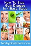 How To Stop Gum Disease In 4 Easy Steps - Bonus Author Contact Information
