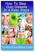 How To Stop Gum Disease In 4 Easy Steps - Bonus Author Contact Information