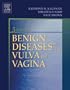 Benign Diseases of the Vulva and Vagina